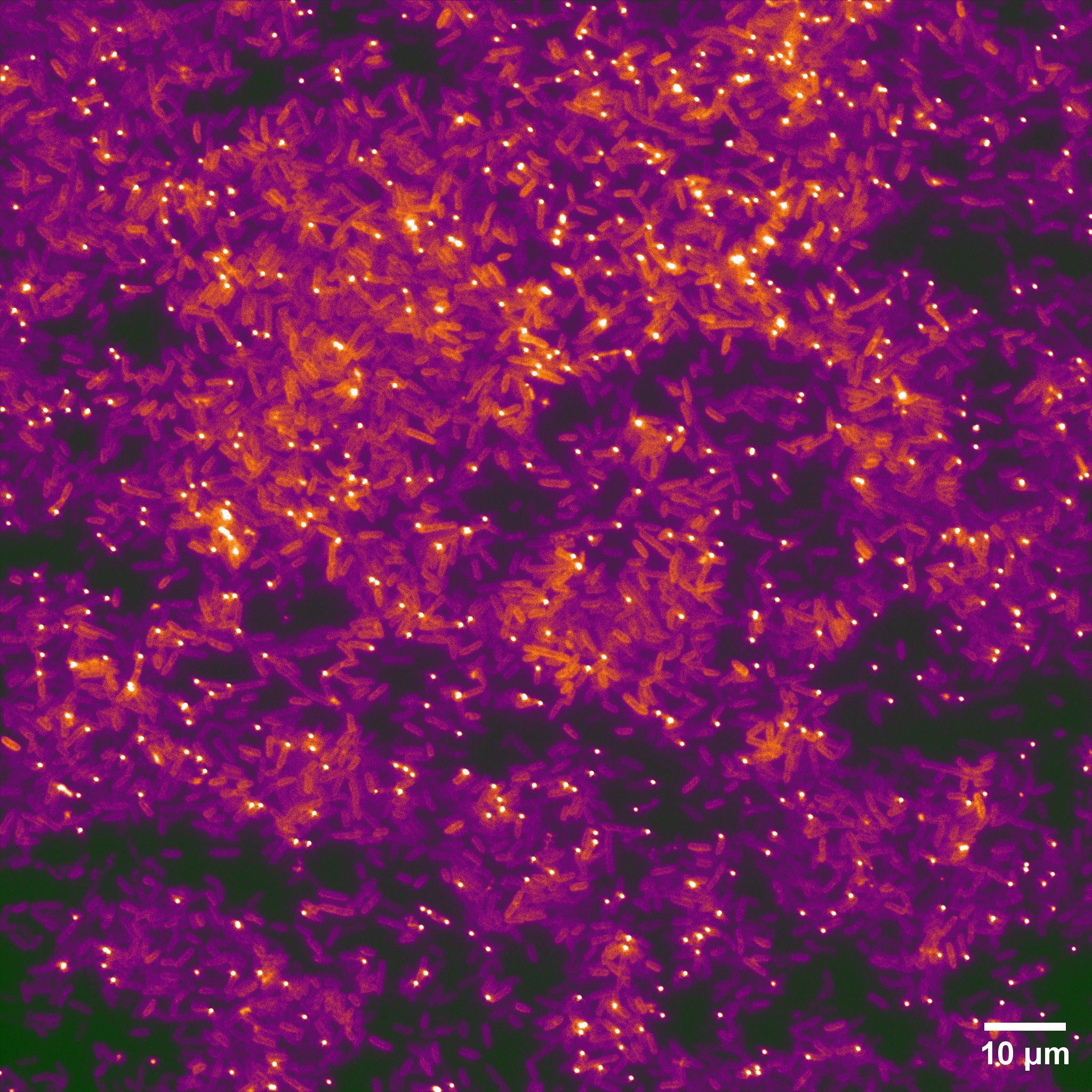 Fluorescence image of many bacteria with bright fluorescent phage particles; scale bar 10 µm